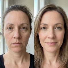 No Morning Puffiness